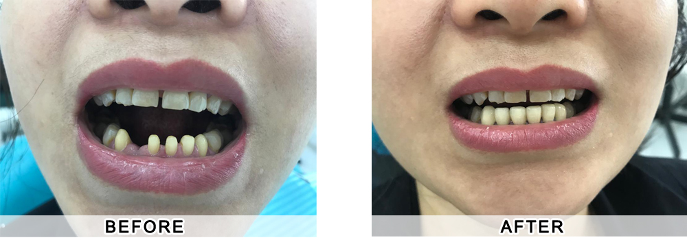 dentist patient4